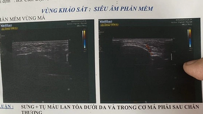 Bị đấm gục trên sân, trọng tài VFF lên tiếng tố cáo