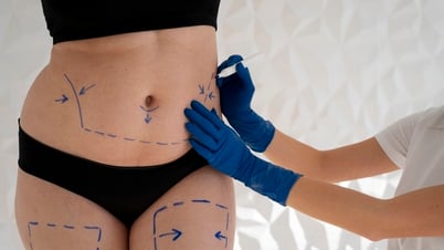 Có nên tiêm tan mỡ để giảm béo?
