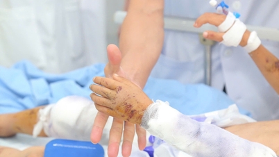 Sức khỏe hai trẻ bị lũ quét ở Làng Nủ đã có cải thiện