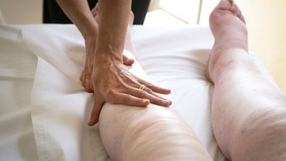 Éléphantiasis depuis de nombreuses années en raison d'un lymphœdème