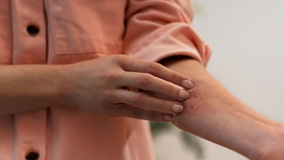 Nguyên nhân da nổi mẩn đỏ