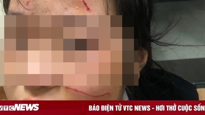 Nữ sinh Hà Nội đánh em lớp dưới chảy máu mặt bị buộc thôi học 6 ngày