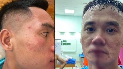 'Xuân Nam gây hấn trước với Văn Sơn, VPF đề nghị xử nghiêm'