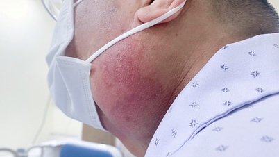 紅茶を飲んでいる男性、12cmの腫瘍を患う