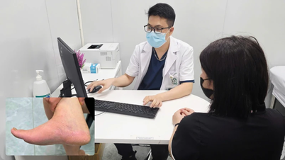 Itchy skin, be careful of infections caused by floods