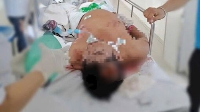 Người đàn ông bị điện giật nguy kịch, gia cảnh khó khăn