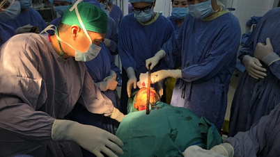 Xuyên đêm nghẹt thở gỡ thanh sắt đâm xuyên mặt nam thanh niên
