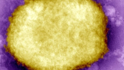 The Netherlands detects the first case of infection with the new monkeypox variant.
