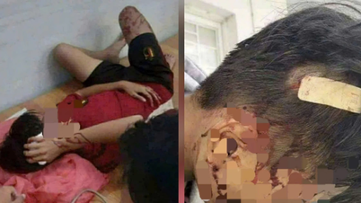 Konflik peribadi, pelajar darjah 8 dipukul dengan kayu oleh rakan dan dimasukkan ke hospital