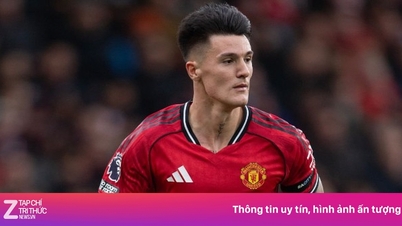 MU mot Brighton: Sesko tilbake i startoppstillingen
