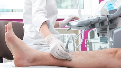 The role of Doppler ultrasound in detecting stroke risk