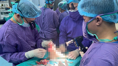 Opětovné zasazení utržené končetiny 19leté studentky při srážce s velkoobjemovým motocyklem