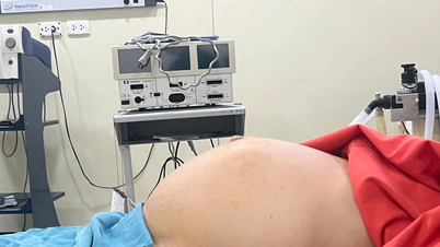 患者のために重さ約10kgの巨大な子宮筋腫を除去する手術