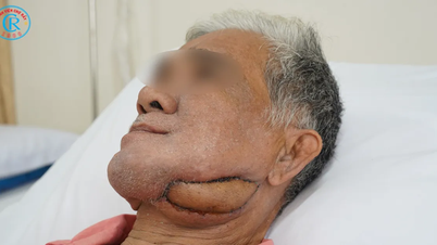 پلاسٹک سرجری سے مریضوں کو احساس کمتری پر قابو پانے میں مدد ملتی ہے۔