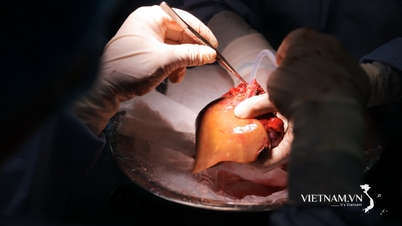 National Children's Hospital develops specialized liver transplant techniques for pediatric patients