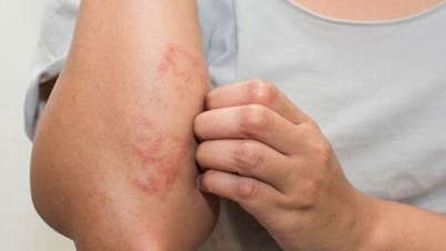 Lékařské novinky 2. listopadu: Vzácné genetické kožní onemocnění vyléčeno díky nové technice