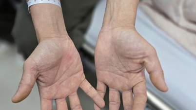 คู่รักหนุ่มสาวในฮานอยเป็นอัมพาตหลังใช้ 'แก๊สหัวเราะ'