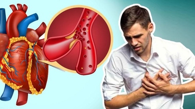 למה אנשים עם מחלות לב וכלי דם צריכים לשים לב בעונה הקרה?