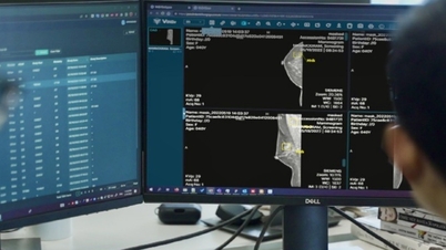 Vietnam mempunyai produk AI untuk diagnosis mamografi yang diiktiraf oleh FDA.