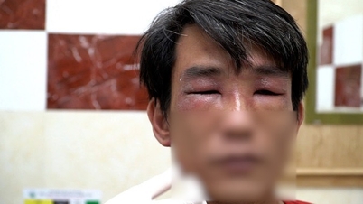 হো চি মিন সিটিতে আবারও লাল পিঁপড়ার আক্রমণ, চিকিৎসার জন্য "কৌশল" ব্যবহার না করার জন্য ডাক্তাররা সতর্ক করেছেন