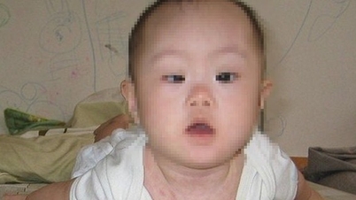 Děti s neobvyklou únavou mohou mít vrozenou myastenickou poruchu.