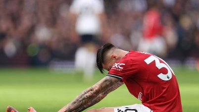 MU raakte in paniek omdat Sesko een ernstige blessure opliep