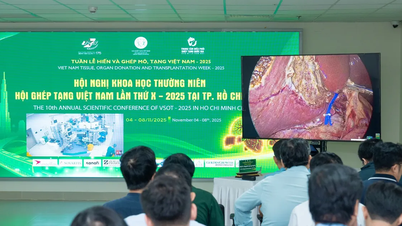 Vinmec demonstreert complexe levende levertransplantatietechniek op de Vietnam Organ Transplant Conference 2025