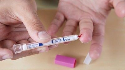 온라인 HIV 자가 검사 모델의 효과