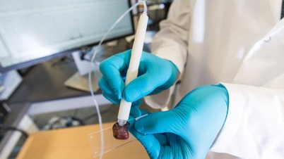 Apparatet oppdager kreft på bare 10 sekunder