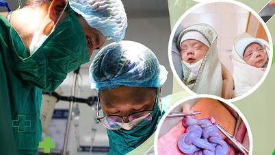 ការសង្គ្រោះទាន់ពេលនៃកូនភ្លោះដែលមានទងផ្ចិតរមួលដូចជា "ចងសក់" នៅពេលមានផ្ទៃពោះ 30 សប្តាហ៍