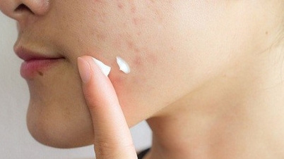 Thu hồi 46 loại mỹ phẩm trên toàn quốc