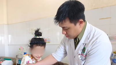 Una joven se somete a 15 cirugías tras sufrir quemaduras en todo el cuerpo.