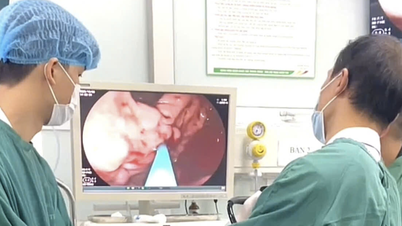 Banyak teknik yang dapat menyembuhkan kanker gastrointestinal secara tuntas jika terdeteksi dini.