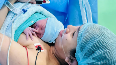 Doğum Zamanı Seçimi: Birçok potansiyel risk!