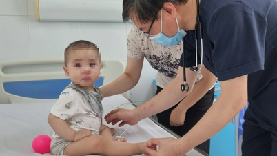 Skiftende årstider: Influensaepidemien øker raskt, hånd-, fot- og munnsyke er fortsatt på sitt høyeste