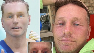 Australian man 'became famous' after coming to Vietnam for cosmetic surgery