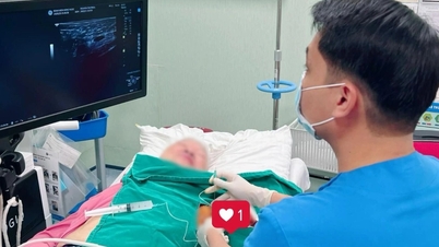 78-årig kvinna sover igen efter fyra år av smärta från bältros