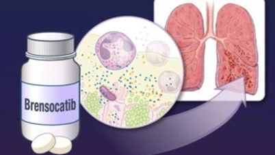 اتحادیه اروپا داروی جدیدی را برای درمان بیماری مزمن شدید ریه تایید کرد