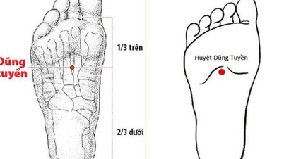 Les médecins de médecine traditionnelle recommandent certaines mesures pour prévenir les AVC par temps froid.