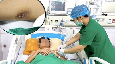 បុរសវ័យក្មេងដែលមានជំងឺ Whitmore អាប់សពហុសរីរាង្គ