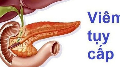 علائم پانکراتیت چیست و از چه غذاهایی باید پرهیز کرد؟