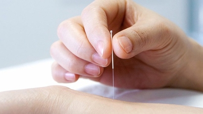 Akupunkturbehandlung der Prostatitis