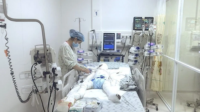 Téměř 100 dní bojují o život šestiletého chlapce s těžkými popáleninami