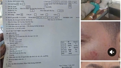 Policie vyšetřuje případ rvačky ředitele a učitele na festivalu 20. listopadu