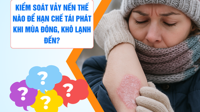 Hvordan kontrollere psoriasis for å begrense tilbakefall i kalde, tørre vinterperioder?