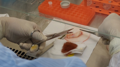 Sel stem boleh disimpan sehingga 50 tahun.