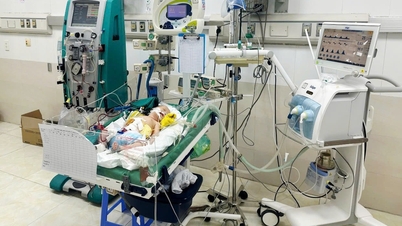 Cứu sống trẻ sơ sinh bị sốc nhiễm khuẩn do viêm phúc mạc, thủng ruột