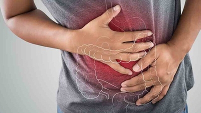 अल्सरेटिव कोलाइटिस के सामान्य लक्षण