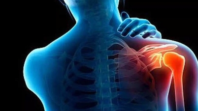 Omuz ağrısını en çabuk hafifleten egzersizler hangileridir?