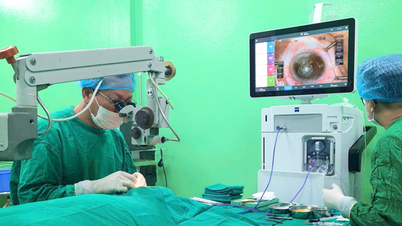 Szürkehályog – Részletes ok- és kezelési javaslatok szakértőtől